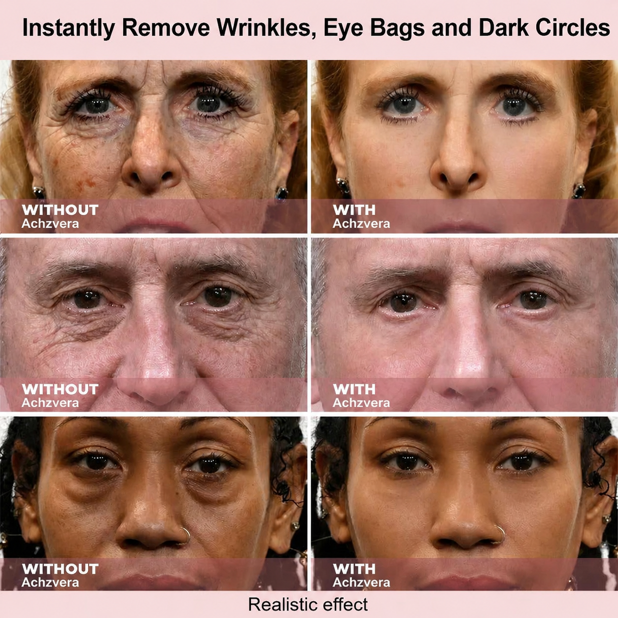 Results in 60 Seconds - Achzvera Rapid Wrinkle-Reducing Serum for Wrinkles, Bags & Dark Circles