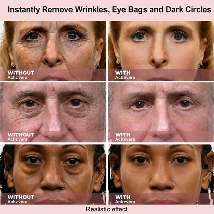 Results in 60 Seconds - Achzvera Rapid Wrinkle-Reducing Serum for Wrinkles, Bags & Dark Circles