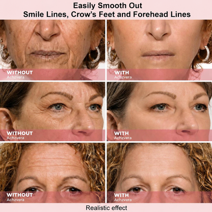 Results in 60 Seconds - Achzvera Rapid Wrinkle-Reducing Serum for Wrinkles, Bags & Dark Circles