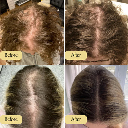 Achzvera Hair Growth Oil