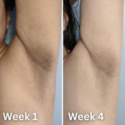 Achzvera® Skin Brightening Deodorant