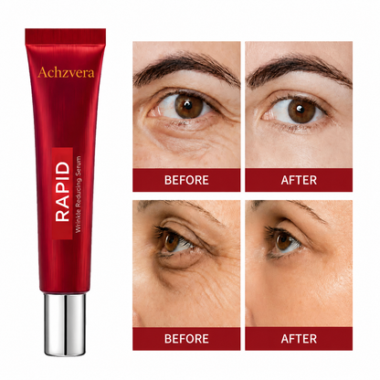 Results in 60 Seconds - Achzvera Rapid Wrinkle-Reducing Serum for Wrinkles, Bags & Dark Circles